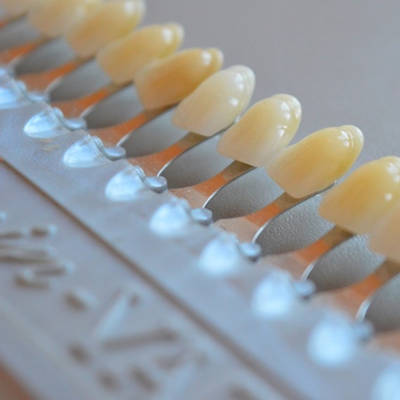 Zahnfarbebestimmungspalette